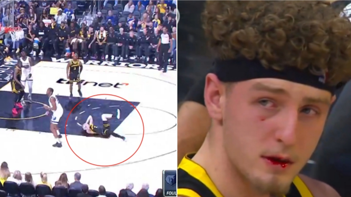 NBA / 【影片】嘴里都是血！波傑姆斯基防守時被擊中面部，倒地痛苦捂臉，已返更衣室處理