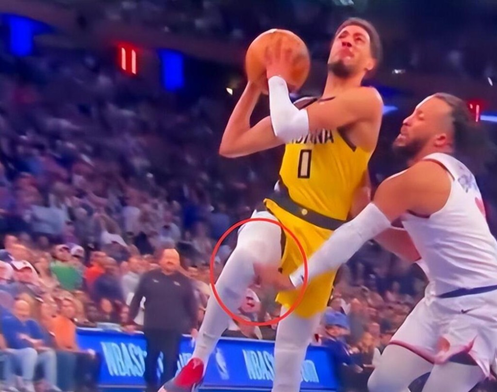 NBA / 【影片】尼克悲壯英雄!布朗森拼到左手骨折,導致搶七大戰提前退場,他已打出精彩一季!-黑特籃球-NBA新聞影音圖片分享社區