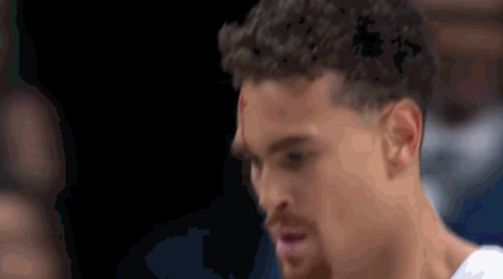 NBA / 【影片】獨行俠又遭傷病魔咒:兩人意外相撞一人頭部流血,哈里森黑臉扭頭離場!-黑特籃球-NBA新聞影音圖片分享社區