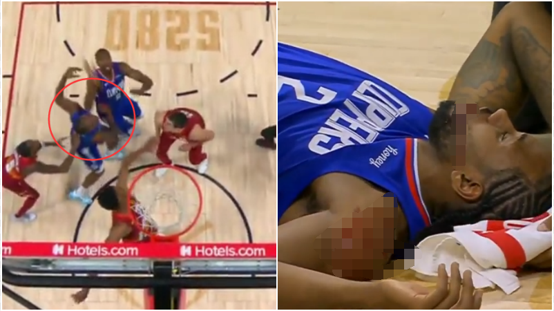 【影片】突發！Leonard搶籃板被Ibaka鐵肘誤傷，血流滿面返回更衣室！-黑特籃球-NBA新聞影音圖片分享社區