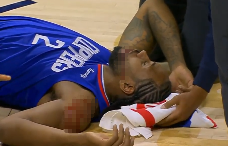 【影片】Leonard輕描淡寫砍21分，最後時刻卻被隊友誤傷血流滿面，最新消息：嘴唇撕裂縫了八針！-黑特籃球-NBA新聞影音圖片分享社區