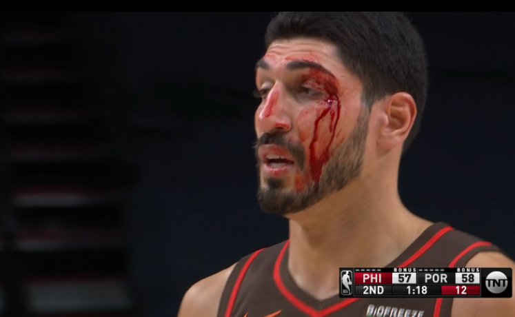 【影片】慎入！Kanter搶籃板時被隊友誤傷，滿臉是血表情卻很淡定！-黑特籃球-NBA新聞影音圖片分享社區