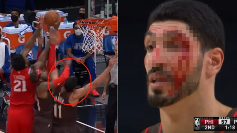 【影片】慎入！Kanter搶籃板時被隊友誤傷，滿臉是血表情卻很淡定！-黑特籃球-NBA新聞影音圖片分享社區