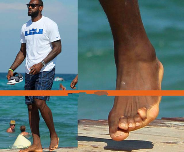 你以為NBA球員賺上千萬很容易嗎？看這些照片就明白，詹姆斯腳趾早已變形！