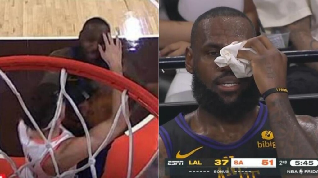 NBA / 【影片】詹姆斯被對手戳眼痛苦倒地！出現開放性傷口，裁判吹罰普通犯規！